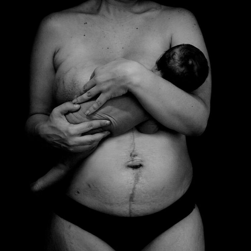 Des femmes partagent des photos brutes de leur corps post-partum qui montrent la réalité dont personne ne parle