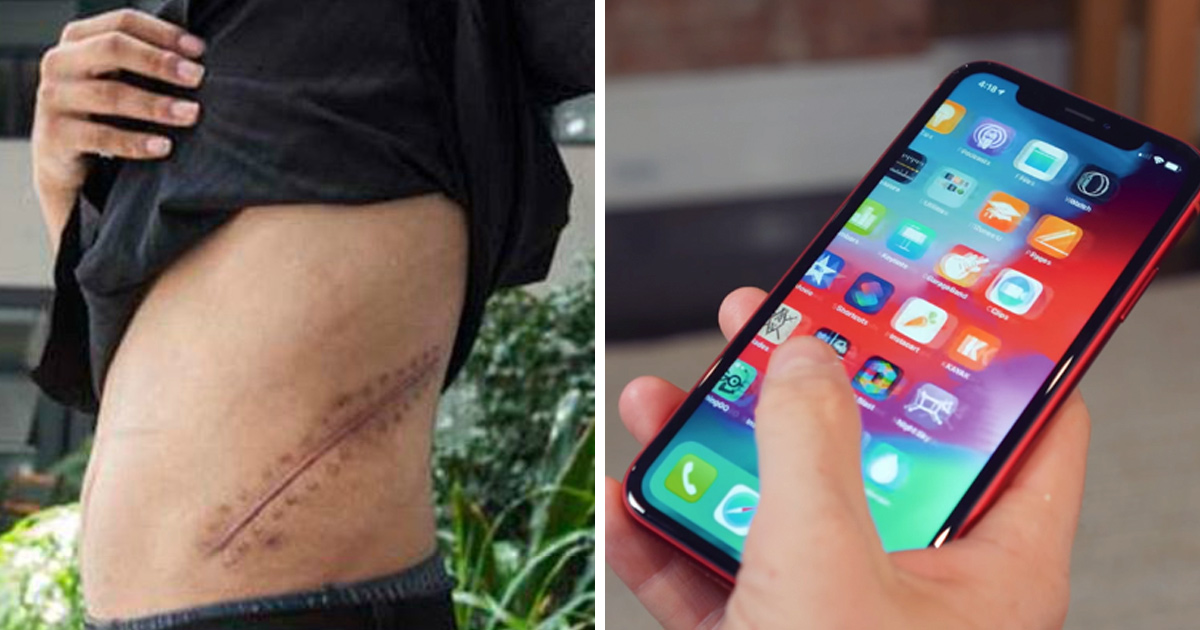 Un adolescent qui a vendu son rein pour obtenir un iPhone est maintenant alité à vie
