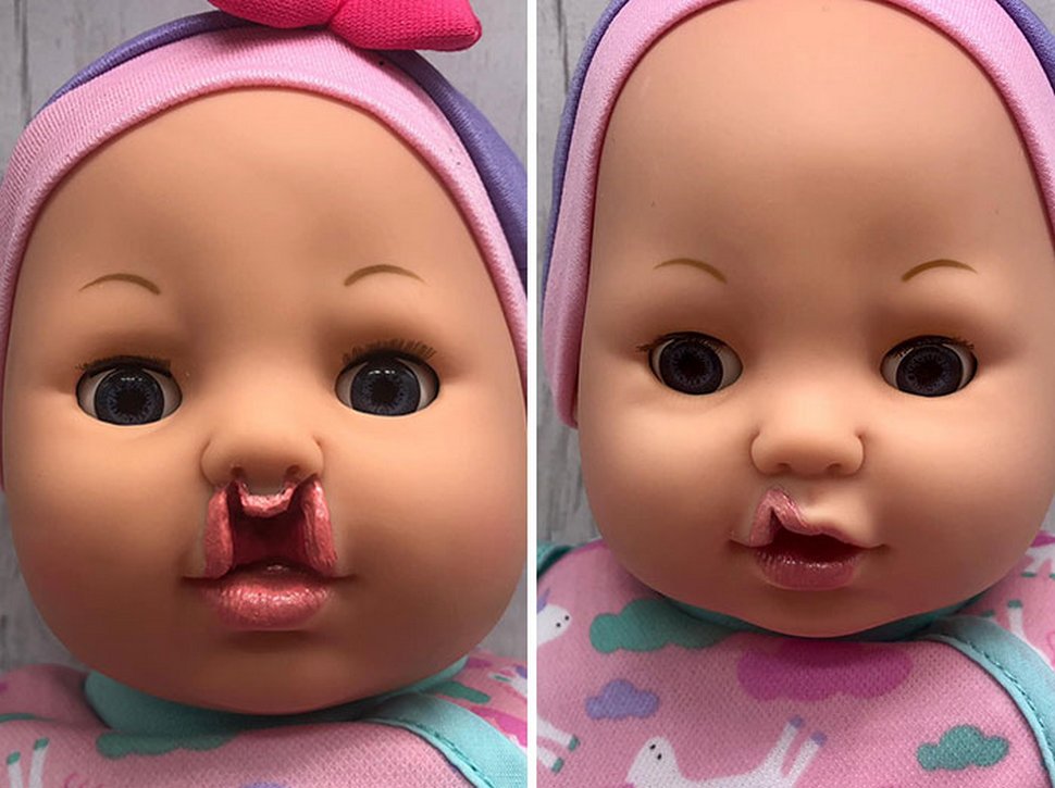 Cette mère a commencé à fabriquer des poupées inclusives après en avoir trouvé aucune avec des appareils auditifs pour sa fille sourde