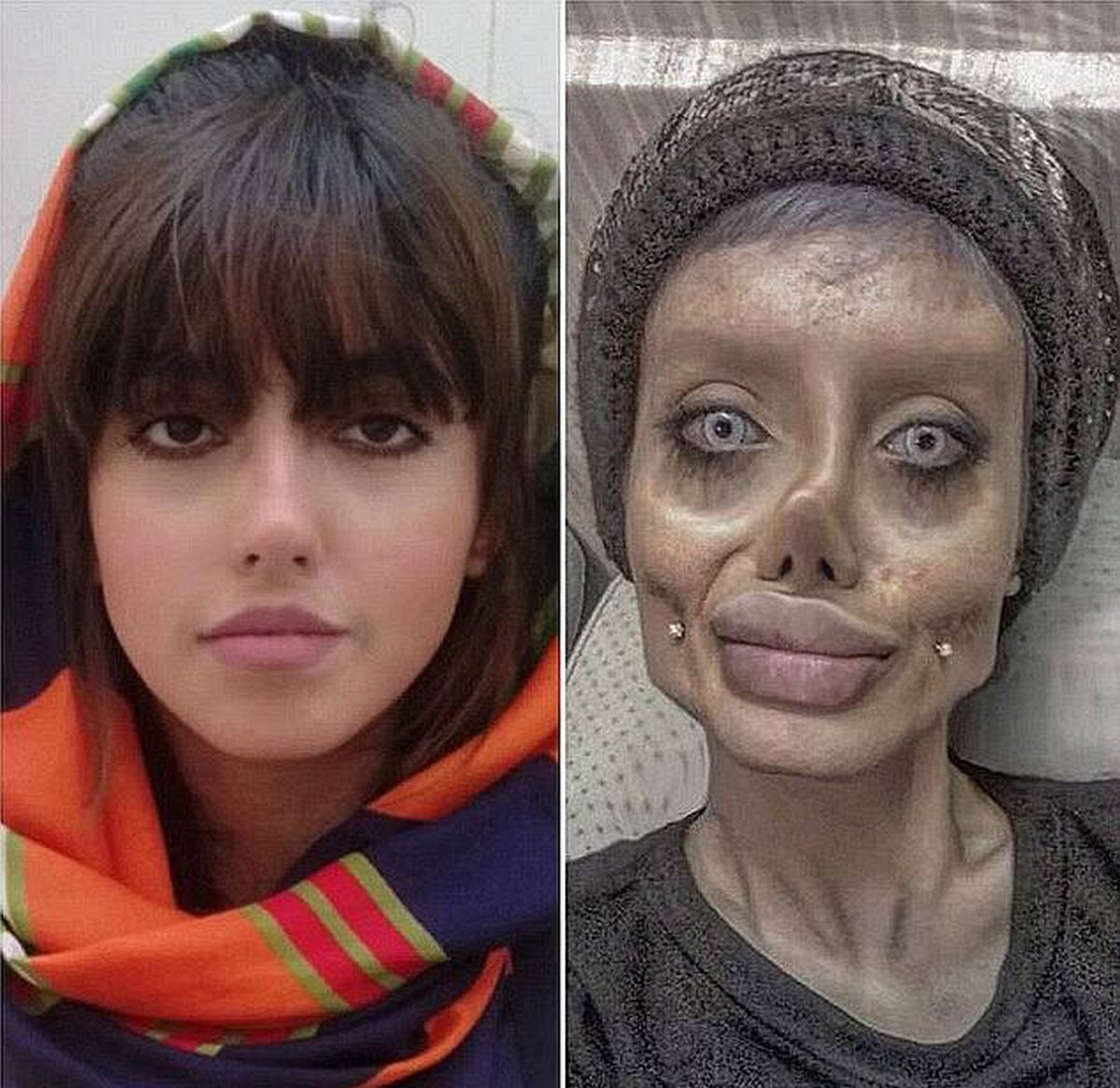 Une femme iranienne surnommée « Zombie Angelina Jolie » a été condamnée à 10 ans de prison