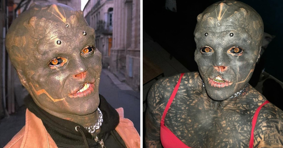 Cet homme sans nez qui s’est fait enlever la lèvre supérieure pour ressembler à un extraterrestre a maintenant du mal à parler