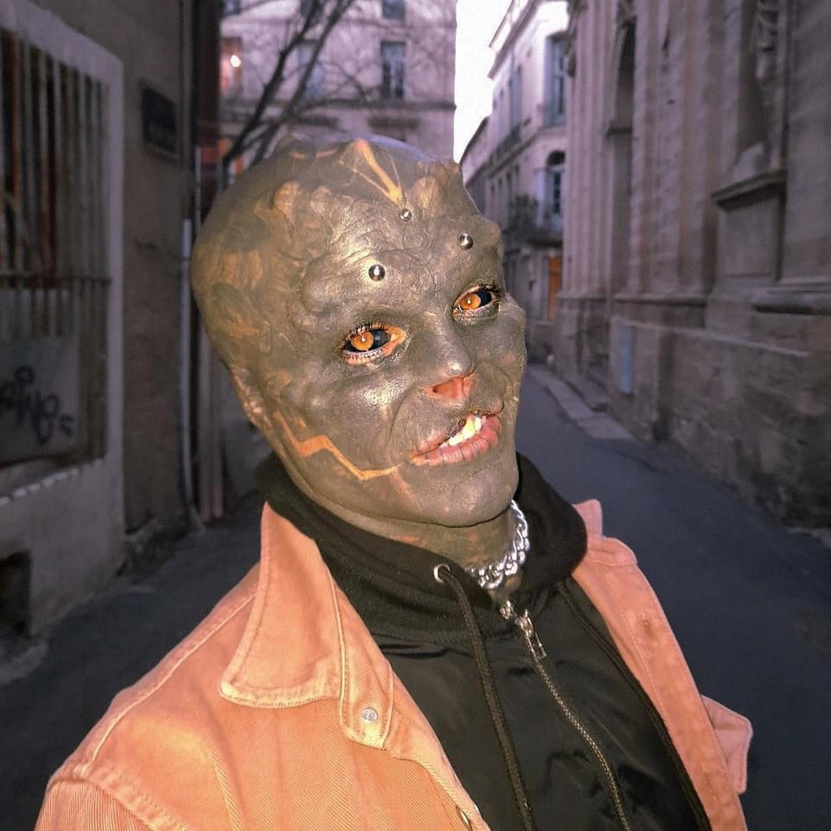 Cet homme sans nez qui s’est fait enlever la lèvre supérieure pour ressembler à un extraterrestre a maintenant du mal à parler