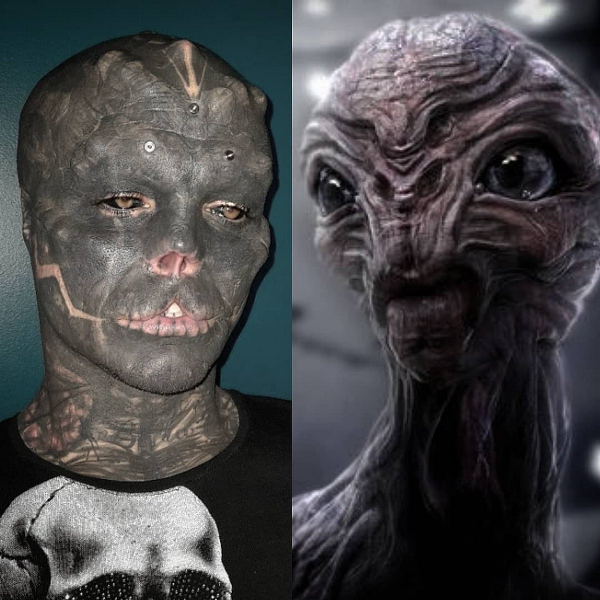 Cet homme sans nez qui s’est fait enlever la lèvre supérieure pour ressembler à un extraterrestre a maintenant du mal à parler