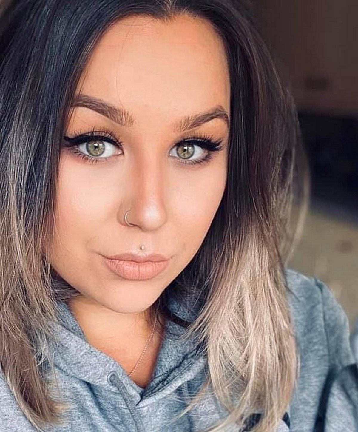 Cette femme qui a deux vagins a pris la parole pour sensibiliser les gens à sa condition