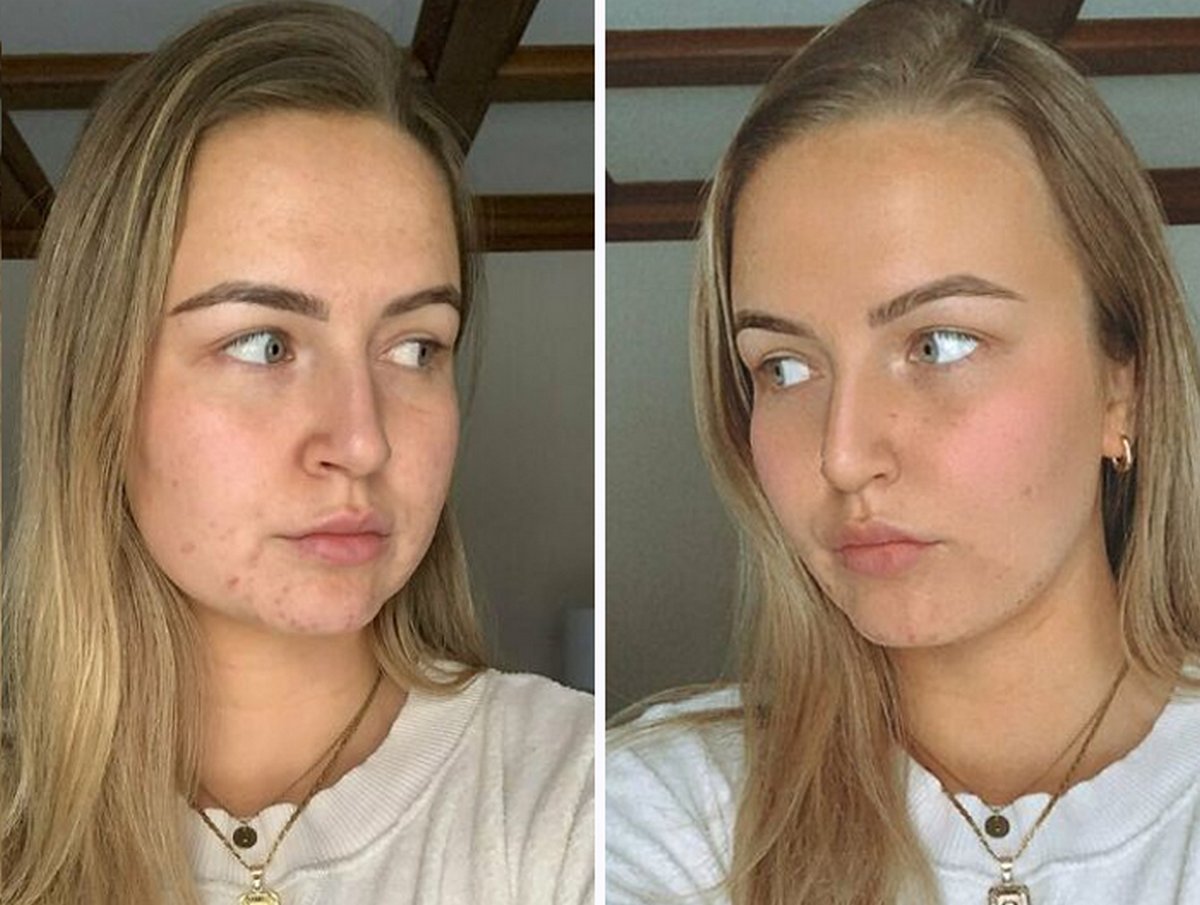 Ces femmes ont participé au défi #FilterDrop sur Instagram et ont montré leur visage sans filtre pour lutter contre les publicités de beauté retouchées