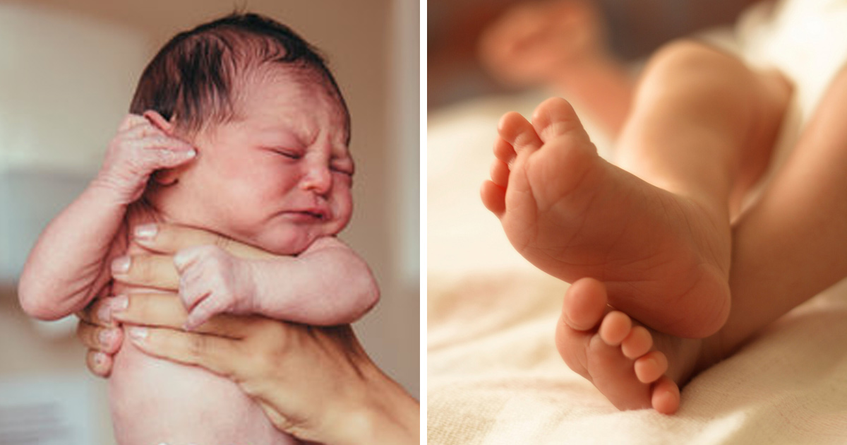 Ce Bebe Garcon Est Le Premier A Naitre Avec Trois Penis Ipnoze Ce Bebe Garcon Est Le Premier A Naitre Avec Trois Penis Ipnoze