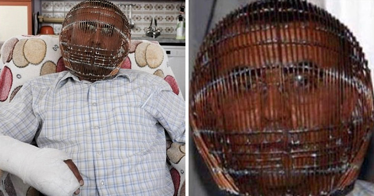 Cet homme s’enferme la tête dans une cage pour tenter d’arrêter de fumer