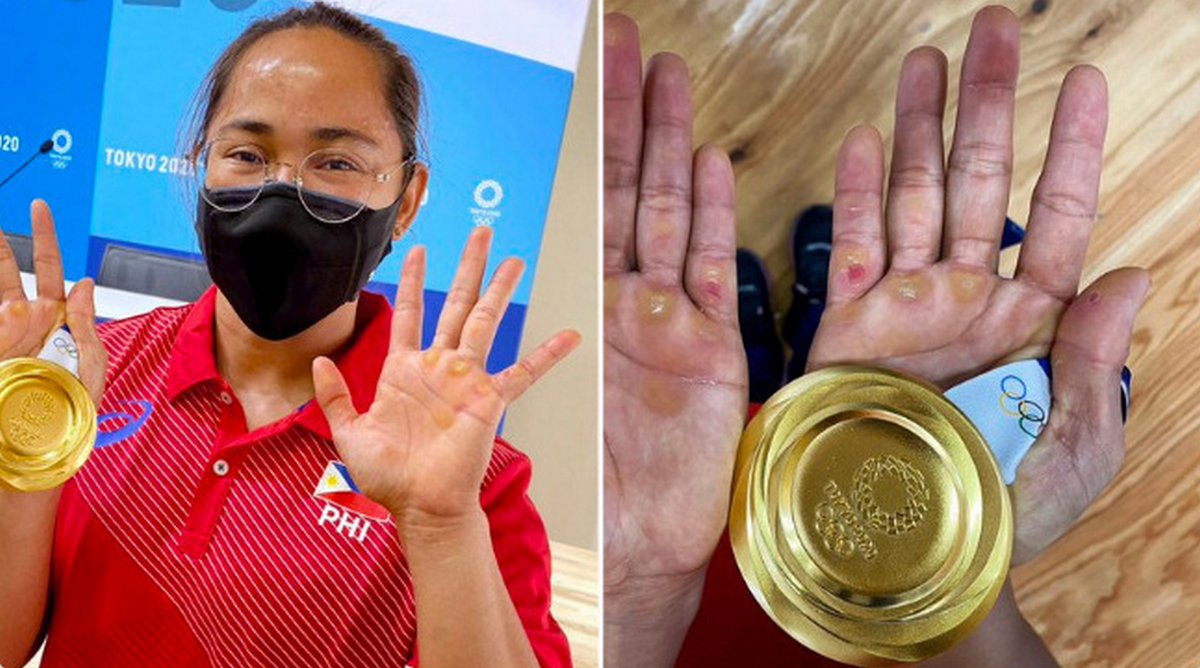 Ces photos flippantes d&#8217;athlètes olympiques vont vous donner une nouvelle perspective sur le corps humain