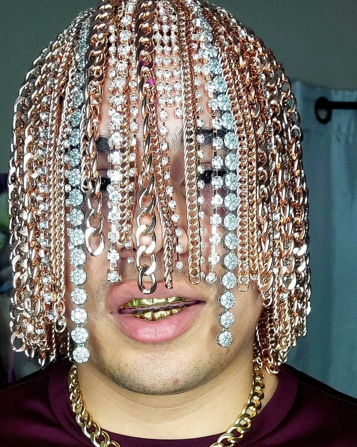 Un rappeur devient le « premier » à se faire implanter chirurgicalement des chaînes en or dans la tête en guise de « cheveux »