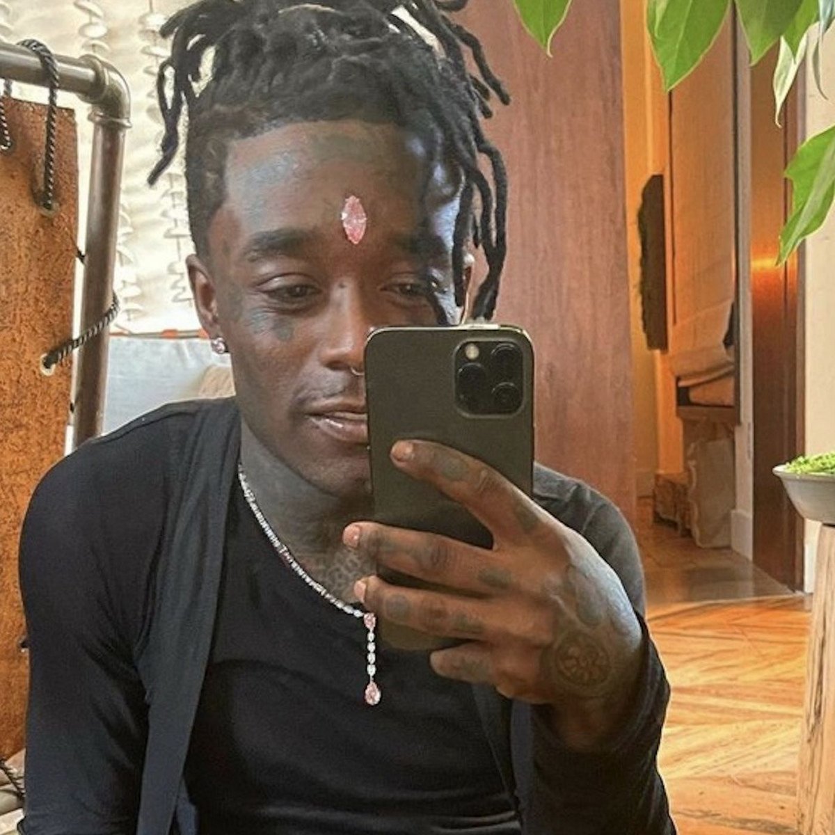 Un rappeur devient le « premier » à se faire implanter chirurgicalement des chaînes en or dans la tête en guise de « cheveux »