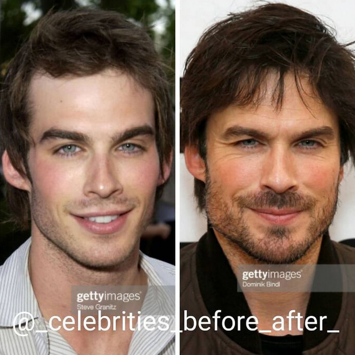 Ces photos côte à côte de célébrités montrent à quel point elles ont changé au fil des ans