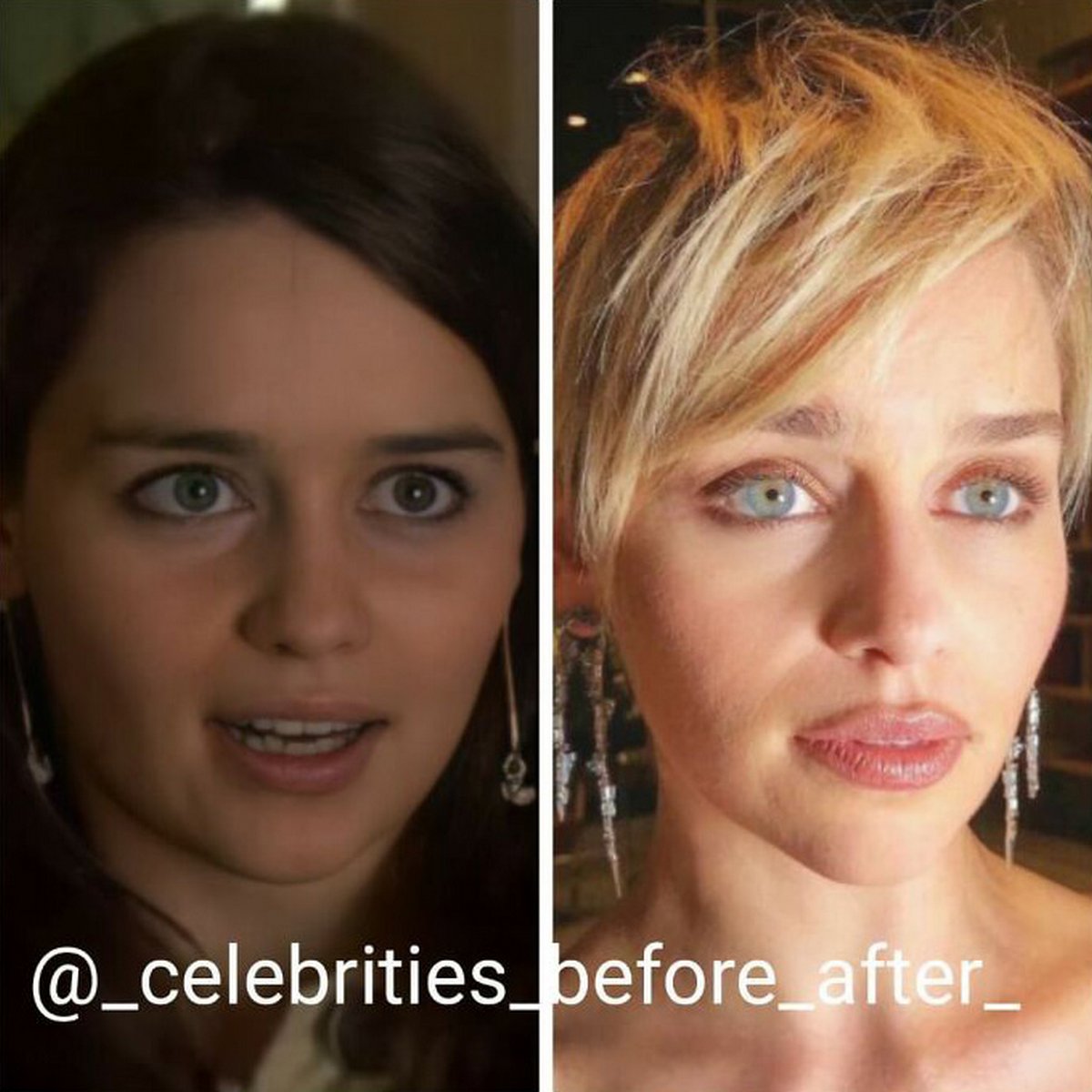 Ces photos côte à côte de célébrités montrent à quel point elles ont changé au fil des ans