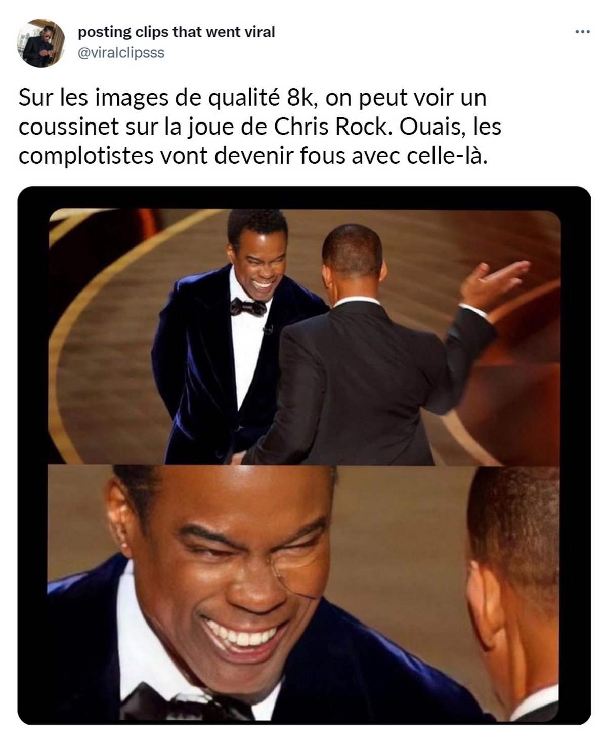 Des complotistes prétendent que Chris Rock portait un coussinet sur la joue lorsque Will Smith l’a giflé