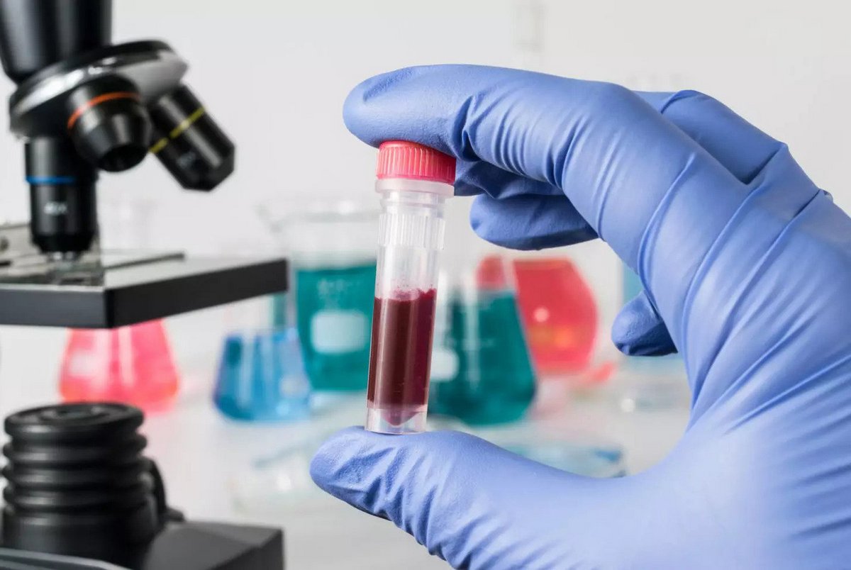Des microplastiques découverts dans le sang humain pour la première fois