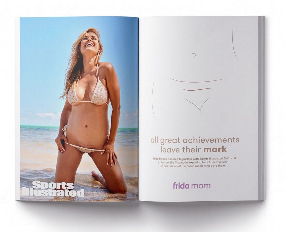 Un mannequin montre sa cicatrice de césarienne dans Sports Illustrated Swimsuit, une première pour le magazine