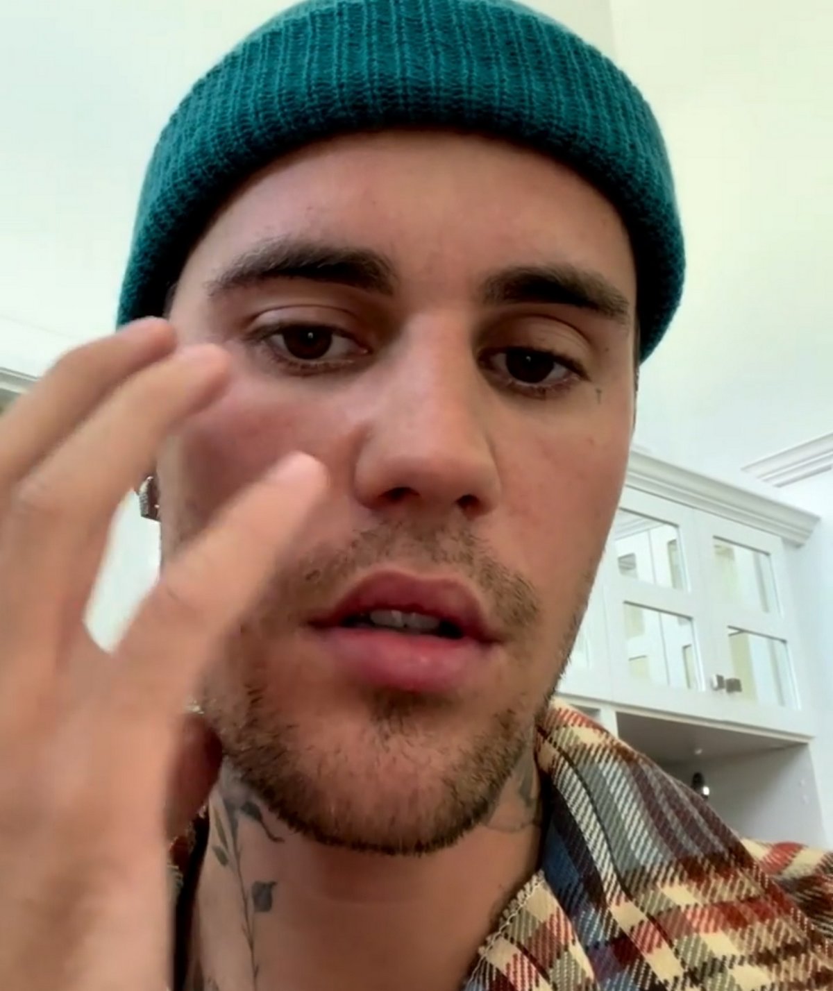 Justin Bieber est paralysé du visage et a de la « difficulté à manger »