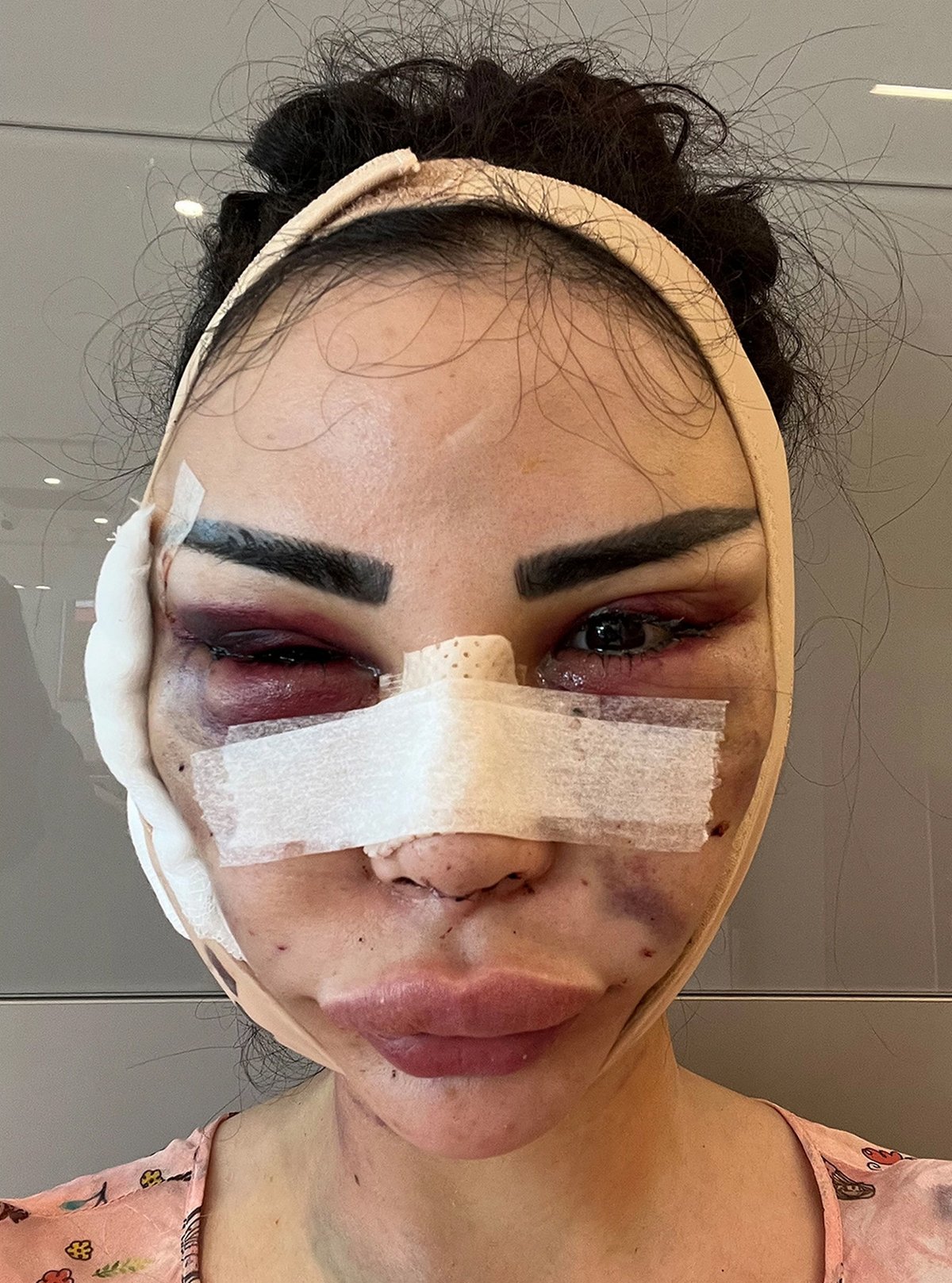 « J’ai payé 600 000 € pour ressembler à Kim Kardashian et je viens de payer 120 000 € pour tout inverser »