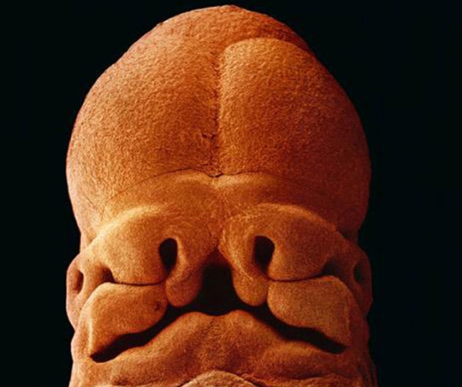 embryon-humain-lennart-nilsson-09
