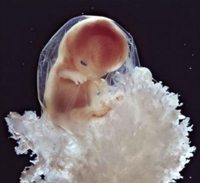 embryon-humain-lennart-nilsson-11