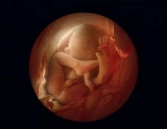 embryon-humain-lennart-nilsson-16