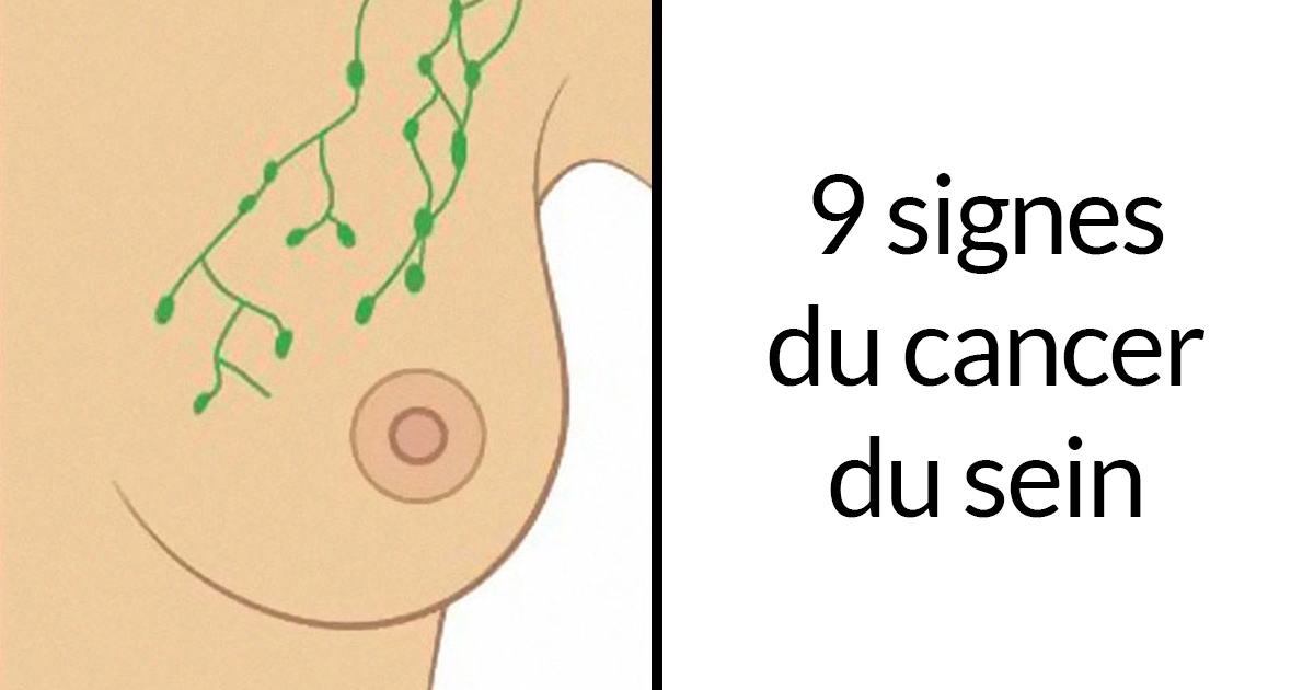 Ces 9 images qui montrent les signes courants du cancer du sein ...