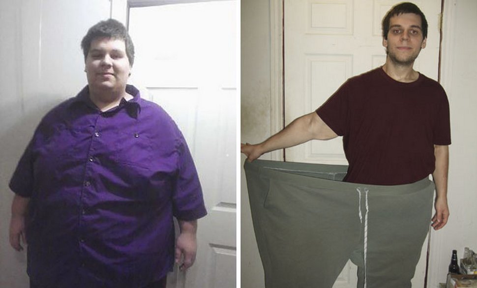 Человек весит 35 кг. Полные люди до и после.
