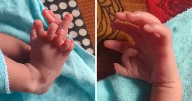 Un bébé naît avec 26 doigts et orteils – ses parents disent qu’il est « l’incarnation d’une déesse »